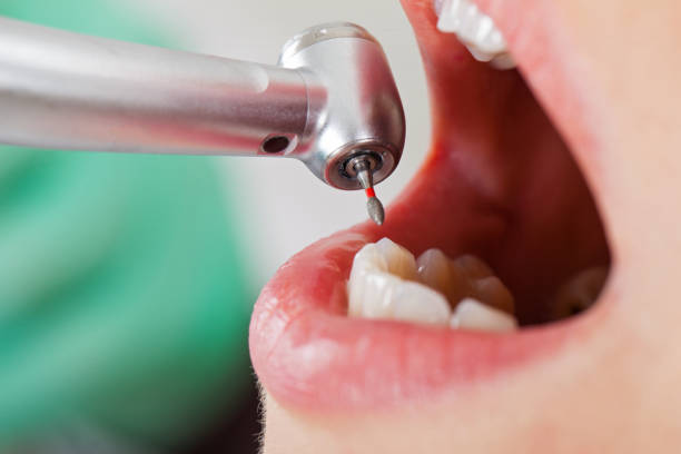 Best Emergency Tooth Extraction in Meyersdale, PA